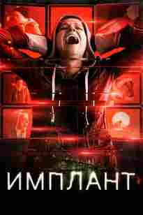 Имплант